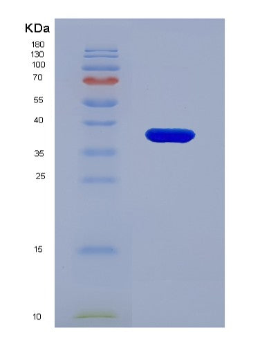 SDS-PAGE analysis of Human PMM1 (Phosphomannomutase 1) - Recombinant Protein, CATHuman PMM1 (Phosphomannomutase 1) - Recombinant Protein