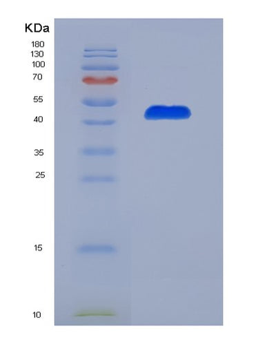 SDS-PAGE analysis of Human WWP2 (Nedd4-Like E3 Ubiquitin-Protein Ligase Wwp2) - Recombinant Protein, CAT# BLT-07330P, showing >90% purity under 15% SDS-PAGE (Reduced)Human WWP2 (Nedd4-Like E3 Ubiquitin-Protein Ligase Wwp2) - Recombinant Protein