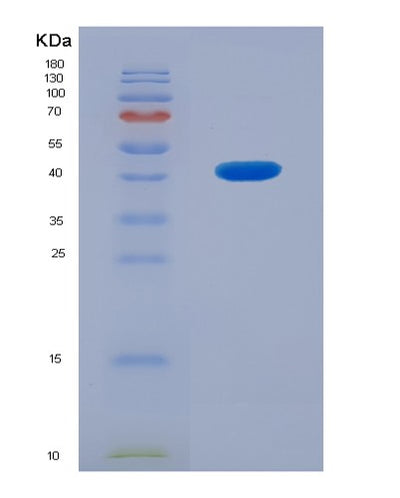 SDS-PAGE analysis of Human STMN2 (Stathmin-2) - Recombinant Protein, CAT# BLT-02893P, showing >85% purity under 15% SDS-PAGE (Reduced)Human STMN2 (Stathmin-2) - Recombinant Protein