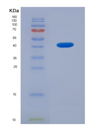 SDS-PAGE analysis of Human STMN2 (Stathmin-2) - Recombinant Protein, CATHuman STMN2 (Stathmin-2) - Recombinant Protein