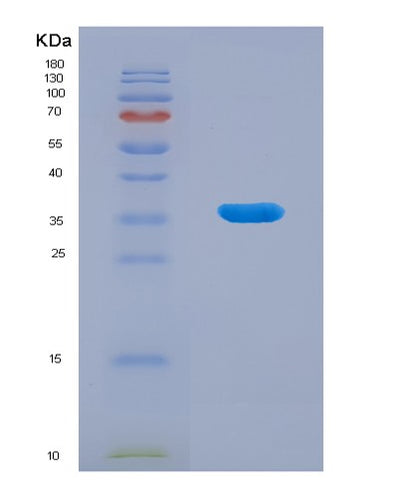 SDS-PAGE analysis of Human BHMT (Betaine--Homocysteine S-Methyltransferase 1) - Recombinant Protein, CAT# BLT-00320P, showing >90% purity under 15% SDS-PAGE (Reduced)Human BHMT (Betaine--Homocysteine S-Methyltransferase 1) - Recombinant Protein