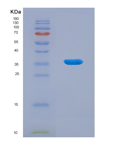 SDS-PAGE analysis of Human BHMT (Betaine--Homocysteine S-Methyltransferase 1) - Recombinant Protein, CATHuman BHMT (Betaine--Homocysteine S-Methyltransferase 1) - Recombinant Protein