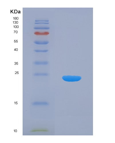 SDS-PAGE analysis of Human PTP4A1 (Protein Tyrosine Phosphatase Type Iva 1) - Recombinant Protein, CATHuman PTP4A1 (Protein Tyrosine Phosphatase Type Iva 1) - Recombinant Protein