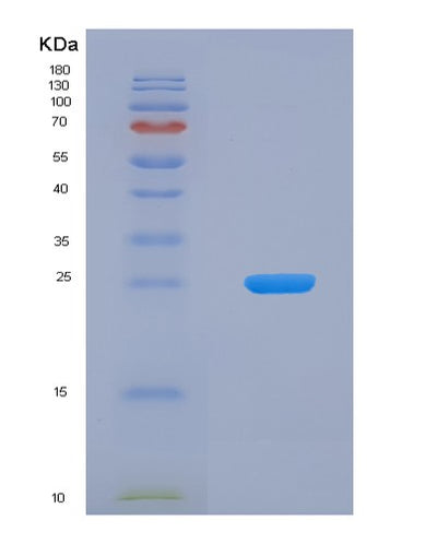 SDS-PAGE analysis of Human CSN2 (Beta-Casein) - Recombinant Protein, CAT# BLT-00719P, showing >95% purity under 15% SDS-PAGE (Reduced)Human CSN2 (Beta-Casein) - Recombinant Protein
