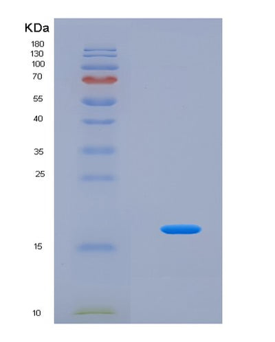 SDS-PAGE analysis of Human TSLP (Thymic Stromal Lymphopoietin) - Recombinant Protein, CAT# BLT-03144P, showing >95% purity under 15% SDS-PAGE (Reduced)Human TSLP (Thymic Stromal Lymphopoietin) - Recombinant Protein