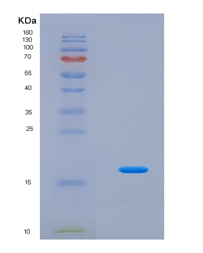 SDS-PAGE analysis of Human TSLP (Thymic Stromal Lymphopoietin) - Recombinant Protein, CATHuman TSLP (Thymic Stromal Lymphopoietin) - Recombinant Protein