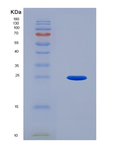 SDS-PAGE analysis of Human UBE2F (Nedd8-Conjugating Enzyme Ube2F) - Recombinant Protein, CAT# BLT-03201P, showing >90% purity under 15% SDS-PAGE (Reduced)Human UBE2F (Nedd8-Conjugating Enzyme Ube2F) - Recombinant Protein