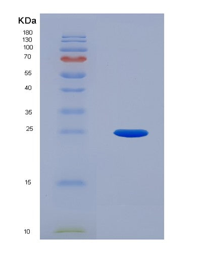 SDS-PAGE analysis of Human UBE2F (Nedd8-Conjugating Enzyme Ube2F) - Recombinant Protein, CATHuman UBE2F (Nedd8-Conjugating Enzyme Ube2F) - Recombinant Protein