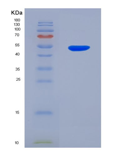 SDS-PAGE analysis of Human UPRT (Uracil Phosphoribosyltransferase Homolog) - Recombinant Protein, CAT# BLT-03249P, showing >95% purity under 15% SDS-PAGE (Reduced)Human UPRT (Uracil Phosphoribosyltransferase Homolog) - Recombinant Protein