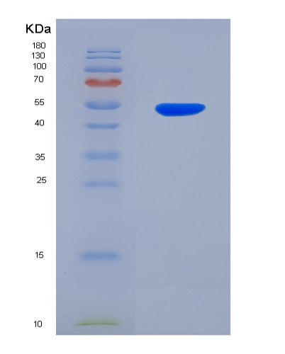 SDS-PAGE analysis of Human UPRT (Uracil Phosphoribosyltransferase Homolog) - Recombinant Protein, CATHuman UPRT (Uracil Phosphoribosyltransferase Homolog) - Recombinant Protein