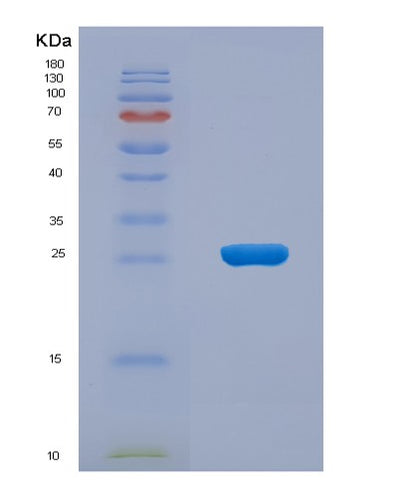 SDS-PAGE analysis of Human PPCDC (Phosphopantothenoylcysteine Decarboxylase) - Recombinant Protein, CAT# BLT-04648P, showing >90% purity under 15% SDS-PAGE (Reduced)Human PPCDC (Phosphopantothenoylcysteine Decarboxylase) - Recombinant Protein