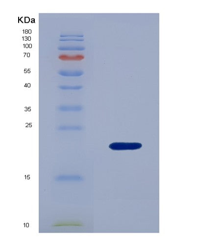 SDS-PAGE analysis of Human MDK (Midkine) - Recombinant Protein, CATHuman MDK (Midkine) - Recombinant Protein