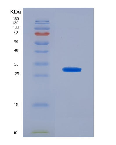 SDS-PAGE analysis of Human ACSF2 (Medium-Chain Acyl-Coa Ligase Acsf2, Mitochondrial) - Recombinant Protein, CAT# BLT-00045P, showing >95% purity under 15% SDS-PAGE (Reduced)Human ACSF2 (Medium-Chain Acyl-Coa Ligase Acsf2, Mitochondrial) - Recombinant Protein