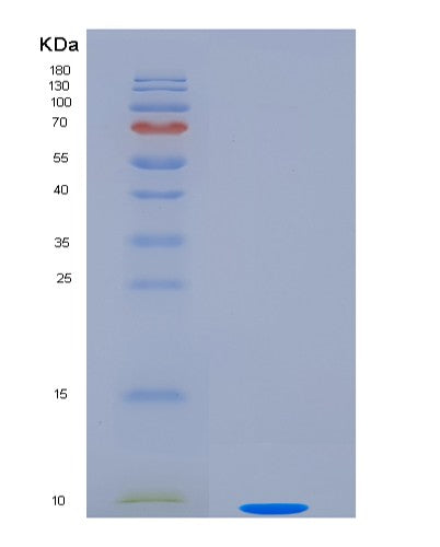 SDS-PAGE analysis of Human EDN1 (Endothelin-1) - Recombinant Protein, CATHuman EDN1 (Endothelin-1) - Recombinant Protein