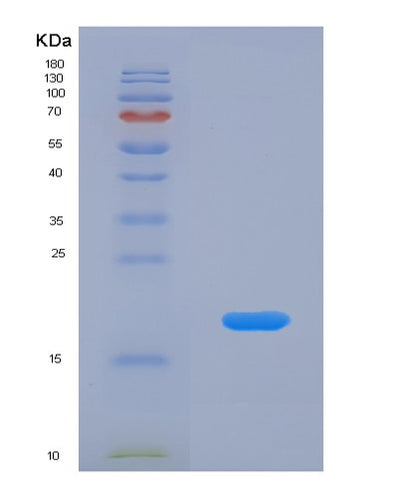 SDS-PAGE analysis of Human QSOX1 (Sulfhydryl Oxidase 1) - Recombinant Protein, CAT# BLT-07747P, showing >90% purity under 15% SDS-PAGE (Reduced)Human QSOX1 (Sulfhydryl Oxidase 1) - Recombinant Protein