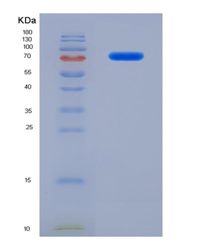 SDS-PAGE analysis of Human ATP9B (Probable Phospholipid-Transporting Atpase Iib) - Recombinant Protein, CAT# BLT-07748P, showing >90% purity under 15% SDS-PAGE (Reduced)Human ATP9B (Probable Phospholipid-Transporting Atpase Iib) - Recombinant Protein