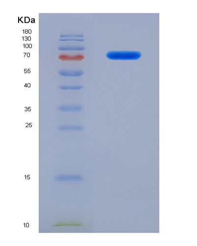 SDS-PAGE analysis of Human ATP9B (Probable Phospholipid-Transporting Atpase Iib) - Recombinant Protein, CATHuman ATP9B (Probable Phospholipid-Transporting Atpase Iib) - Recombinant Protein