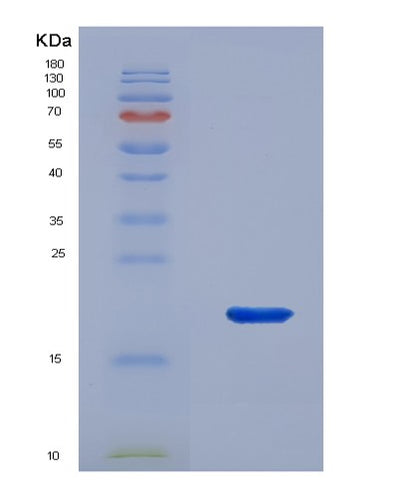 SDS-PAGE analysis of Human CNRIP1 (Cb1 Cannabinoid Receptor-Interacting Protein 1) - Recombinant Protein, CAT# BLT-00650P, showing >90% purity under 15% SDS-PAGE (Reduced)Human CNRIP1 (Cb1 Cannabinoid Receptor-Interacting Protein 1) - Recombinant Protein