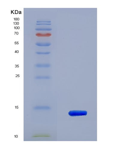 SDS-PAGE analysis of Human S100A16 (Protein S100-A16) - Recombinant Protein, CAT# BLT-06485P, showing >85% purity under 15% SDS-PAGE (Reduced)Human S100A16 (Protein S100-A16) - Recombinant Protein