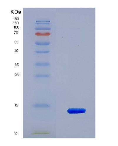 SDS-PAGE analysis of Human S100A16 (Protein S100-A16) - Recombinant Protein, CATHuman S100A16 (Protein S100-A16) - Recombinant Protein