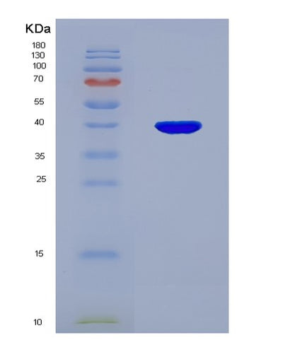 SDS-PAGE analysis of Human OTUB1 (Ubiquitin Thioesterase Otub1) - Recombinant Protein, CAT# BLT-03771P, showing >85% purity under 15% SDS-PAGE (Reduced)Human OTUB1 (Ubiquitin Thioesterase Otub1) - Recombinant Protein