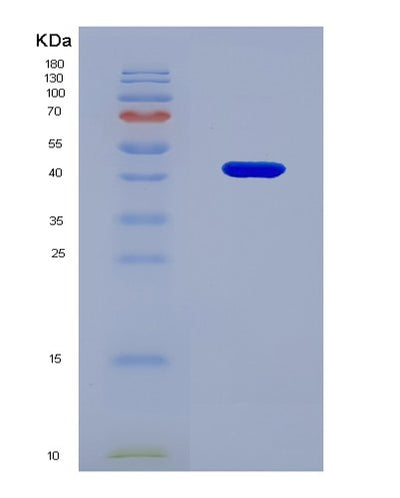 SDS-PAGE analysis of Human ACVR2A (Activin Receptor Type-2A) - Recombinant Protein, CAT# BLT-07749P, showing >90% purity under 15% SDS-PAGE (Reduced)Human ACVR2A (Activin Receptor Type-2A) - Recombinant Protein