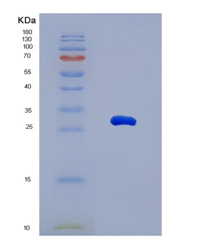 SDS-PAGE analysis of Human MMRN1 (Multimerin-1) - Recombinant Protein, CAT# BLT-07750P, showing >90% purity under 15% SDS-PAGE (Reduced)Human MMRN1 (Multimerin-1) - Recombinant Protein