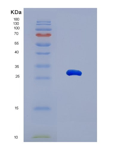 SDS-PAGE analysis of Human MMRN1 (Multimerin-1) - Recombinant Protein, CATHuman MMRN1 (Multimerin-1) - Recombinant Protein