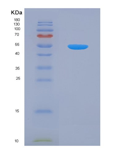 SDS-PAGE analysis of Human MARS2 (Methionine--Trna Ligase, Mitochondrial) - Recombinant Protein, CATHuman MARS2 (Methionine--Trna Ligase, Mitochondrial) - Recombinant Protein