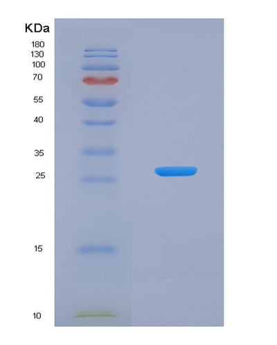 SDS-PAGE analysis of Human BMF (Bcl-2-Modifying Factor) - Recombinant Protein, CAT# BLT-05612P, showing >85% purity under 15% SDS-PAGE (Reduced)Human BMF (Bcl-2-Modifying Factor) - Recombinant Protein
