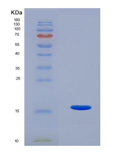 SDS-PAGE analysis of Human ACVR2B (Activin Receptor Type-2B) - Recombinant Protein, CAT# BLT-07756P, showing >90% purity under 15% SDS-PAGE (Reduced)Human ACVR2B (Activin Receptor Type-2B) - Recombinant Protein