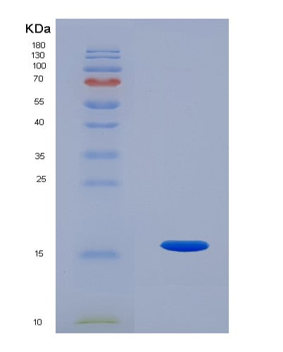 SDS-PAGE analysis of Human ACVR2B (Activin Receptor Type-2B) - Recombinant Protein, CATHuman ACVR2B (Activin Receptor Type-2B) - Recombinant Protein