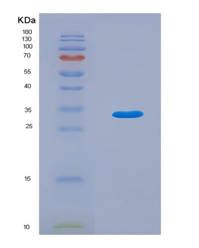 SDS-PAGE analysis of Human OGA (Protein O-Glcnacase) - Recombinant Protein, CAT# BLT-07757P, showing >90% purity under 15% SDS-PAGE (Reduced)Human OGA (Protein O-Glcnacase) - Recombinant Protein