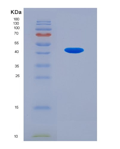 SDS-PAGE analysis of Human OAS2 (2&Human OAS2 (2'-5'-Oligoadenylate Synthase 2) - Recombinant Protein