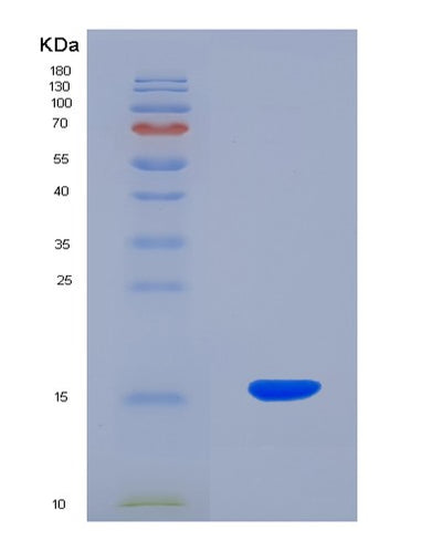 SDS-PAGE analysis of Human MST1 (Hepatocyte Growth Factor-Like Protein) - Recombinant Protein, CAT# BLT-07759P, showing >90% purity under 15% SDS-PAGE (Reduced)Human MST1 (Hepatocyte Growth Factor-Like Protein) - Recombinant Protein