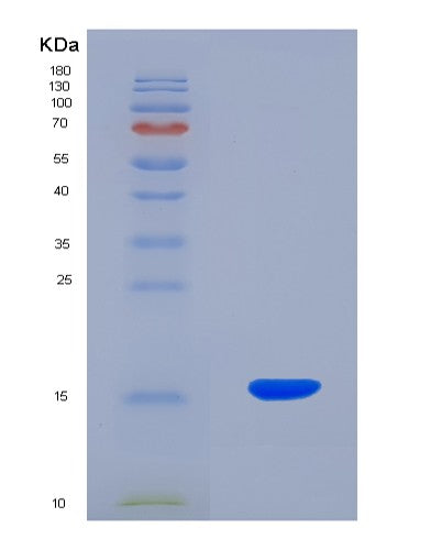 SDS-PAGE analysis of Human MST1 (Hepatocyte Growth Factor-Like Protein) - Recombinant Protein, CATHuman MST1 (Hepatocyte Growth Factor-Like Protein) - Recombinant Protein