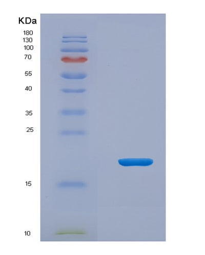 SDS-PAGE analysis of Human MCEE (Methylmalonyl-Coa Epimerase, Mitochondrial) - Recombinant Protein, CAT# BLT-01812P, showing >85% purity under 15% SDS-PAGE (Reduced)Human MCEE (Methylmalonyl-Coa Epimerase, Mitochondrial) - Recombinant Protein