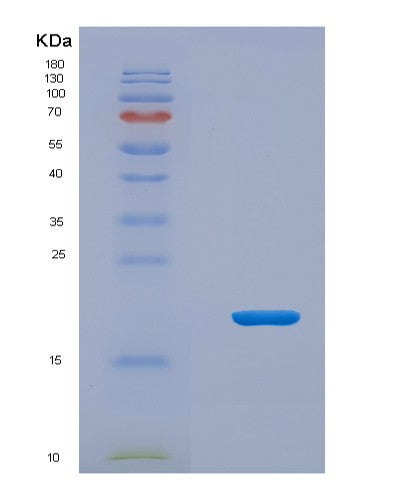 SDS-PAGE analysis of Human MCEE (Methylmalonyl-Coa Epimerase, Mitochondrial) - Recombinant Protein, CATHuman MCEE (Methylmalonyl-Coa Epimerase, Mitochondrial) - Recombinant Protein