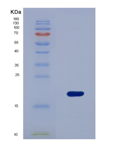 SDS-PAGE analysis of Human AMELX (Amelogenin, X Isoform) - Recombinant Protein, CAT# BLT-00140P, showing >95% purity under 15% SDS-PAGE (Reduced)Human AMELX (Amelogenin, X Isoform) - Recombinant Protein