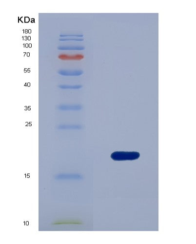 SDS-PAGE analysis of Human AMELX (Amelogenin, X Isoform) - Recombinant Protein, CATHuman AMELX (Amelogenin, X Isoform) - Recombinant Protein