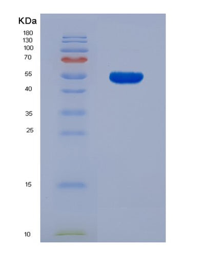 SDS-PAGE analysis of Mouse Prl (Prolactin) - Recombinant Protein, CAT# BLT-07760P, showing >90% purity under 15% SDS-PAGE (Reduced)Mouse Prl (Prolactin) - Recombinant Protein