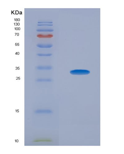 SDS-PAGE analysis of Human CEACAM1 (Cell Adhesion Molecule Ceacam1) - Recombinant Protein, CAT# BLT-07761P, showing >90% purity under 15% SDS-PAGE (Reduced)Human CEACAM1 (Cell Adhesion Molecule Ceacam1) - Recombinant Protein