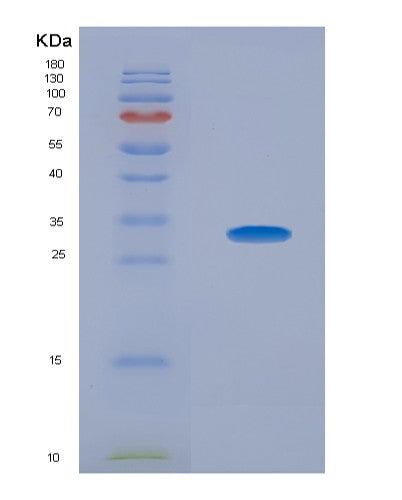 SDS-PAGE analysis of Human CEACAM1 (Cell Adhesion Molecule Ceacam1) - Recombinant Protein, CATHuman CEACAM1 (Cell Adhesion Molecule Ceacam1) - Recombinant Protein