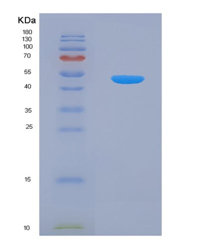 SDS-PAGE analysis of Human APP (Amyloid-Beta Precursor Protein) - Recombinant Protein, CAT# BLT-05239P, showing >95% purity under 15% SDS-PAGE (Reduced)Human APP (Amyloid-Beta Precursor Protein) - Recombinant Protein