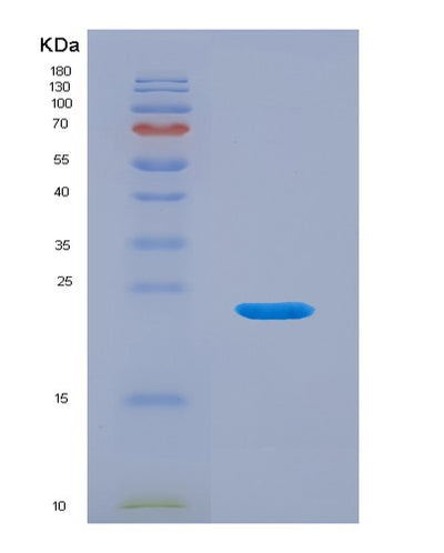 SDS-PAGE analysis of Mouse Mmp12 (Macrophage Metalloelastase) - Recombinant Protein, CAT# BLT-07762P, showing >90% purity under 15% SDS-PAGE (Reduced)Mouse Mmp12 (Macrophage Metalloelastase) - Recombinant Protein