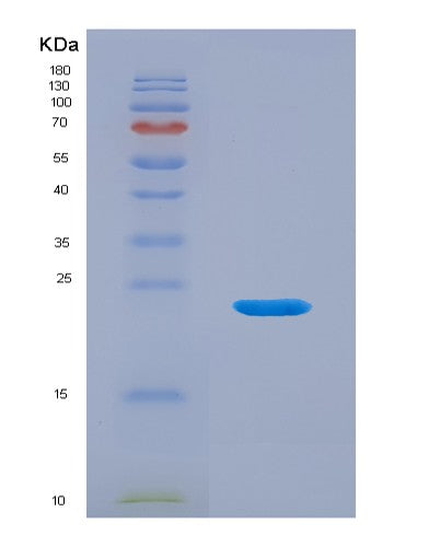SDS-PAGE analysis of Mouse Mmp12 (Macrophage Metalloelastase) - Recombinant Protein, CATMouse Mmp12 (Macrophage Metalloelastase) - Recombinant Protein