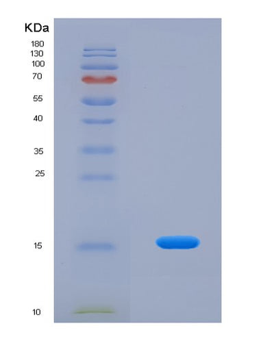 SDS-PAGE analysis of Human MYCBP (C-Myc-Binding Protein) - Recombinant Protein, CAT# BLT-01932P, showing >90% purity under 15% SDS-PAGE (Reduced)Human MYCBP (C-Myc-Binding Protein) - Recombinant Protein