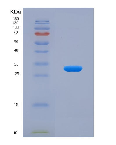 SDS-PAGE analysis of Human TBCB (Tubulin-Folding Cofactor B) - Recombinant Protein, CAT# BLT-02985P, showing >85% purity under 15% SDS-PAGE (Reduced)Human TBCB (Tubulin-Folding Cofactor B) - Recombinant Protein
