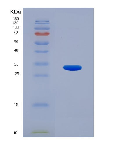 SDS-PAGE analysis of Human CNN2 (Calponin-2) - Recombinant Protein, CAT# BLT-00644P, showing >90% purity under 15% SDS-PAGE (Reduced)Human CNN2 (Calponin-2) - Recombinant Protein