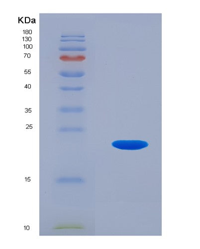 SDS-PAGE analysis of Human PFDN5 (Prefoldin Subunit 5) - Recombinant Protein, CATHuman PFDN5 (Prefoldin Subunit 5) - Recombinant Protein